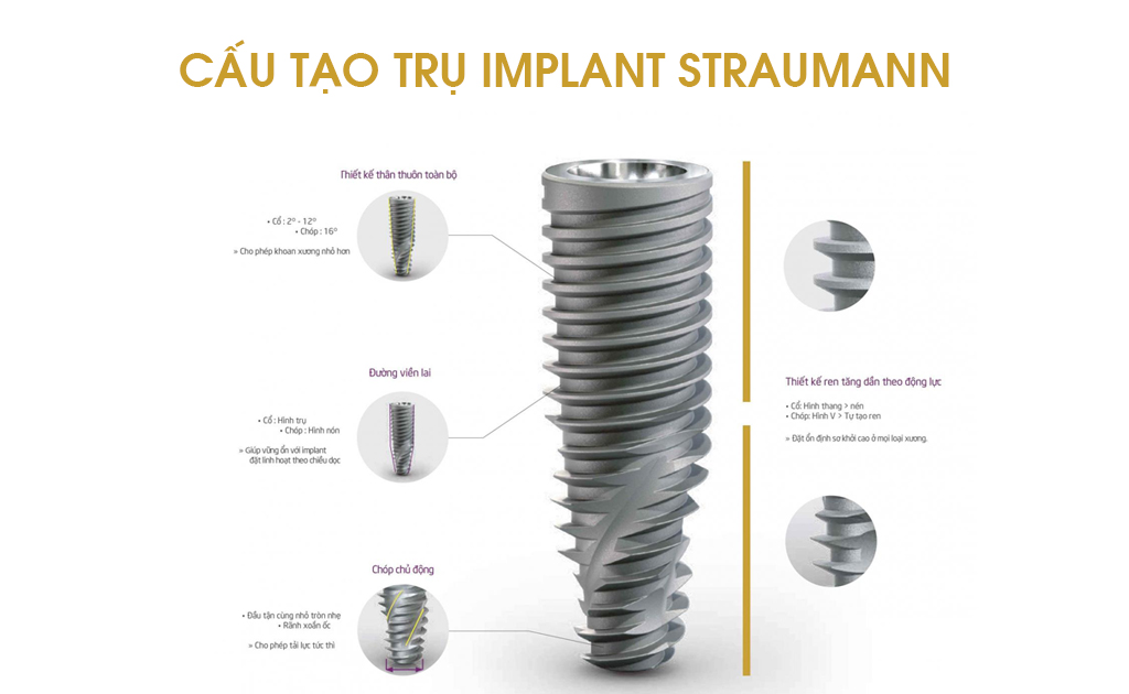 Straumann SLA Implant | Nha khoa Smile Up