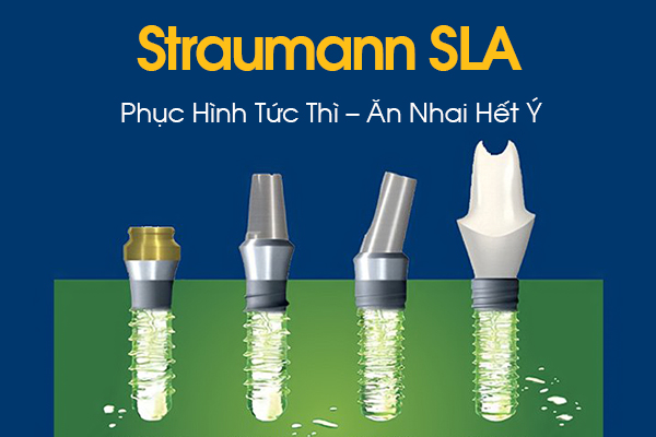 Straumann SLA Implant | Nha khoa Smile Up