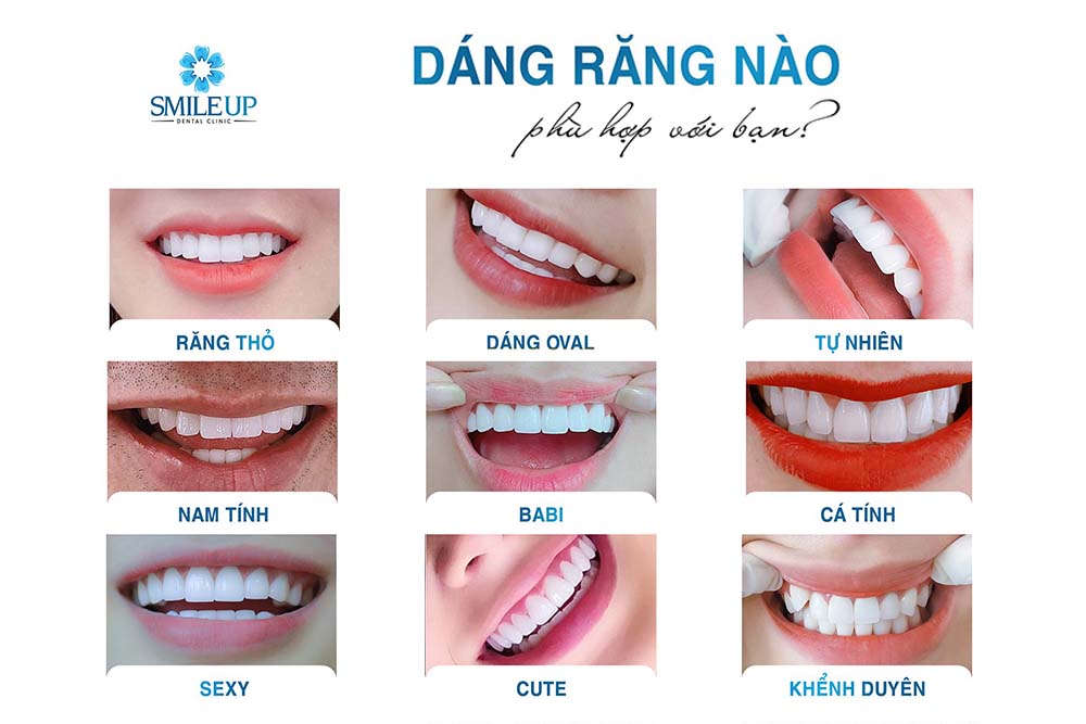 Các Dáng Răng Của Nha Khoa SMILE UP