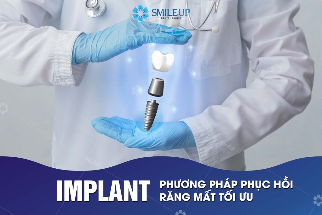 IMPLANT