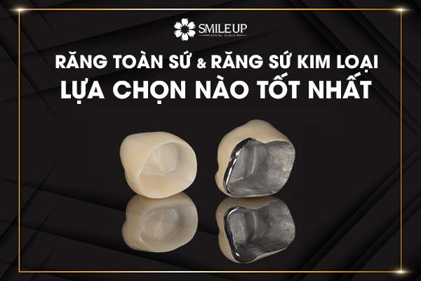 Răng Toàn Sứ và Răng Sứ Kim Loại