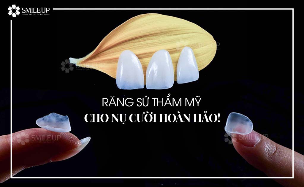 Dán Sứ Veneer | Nha khoa Smile Up