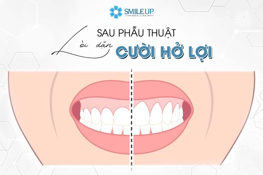 LỜI DẶN SAU PHẪU THUẬT KÉO DÀI THÂN RĂNG