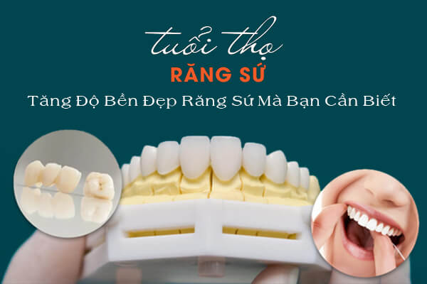 Cách Kéo Dài Tuổi Thọ - Tăng Độ Bền Răng Sứ