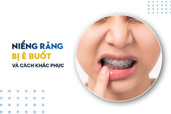 Giảm Ê Buốt Răng Khi Mới Niềng Răng