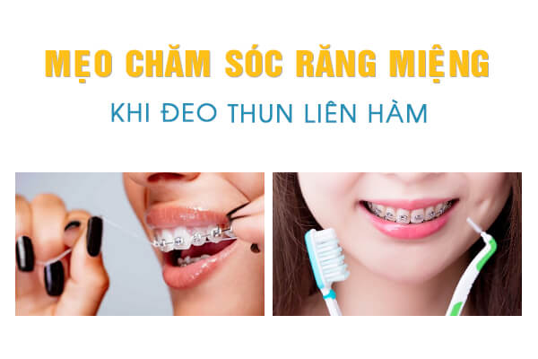 thun liên hàm