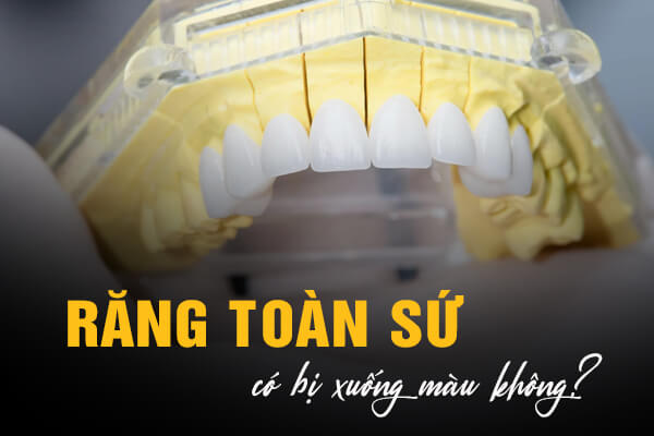 Răng toàn sứ