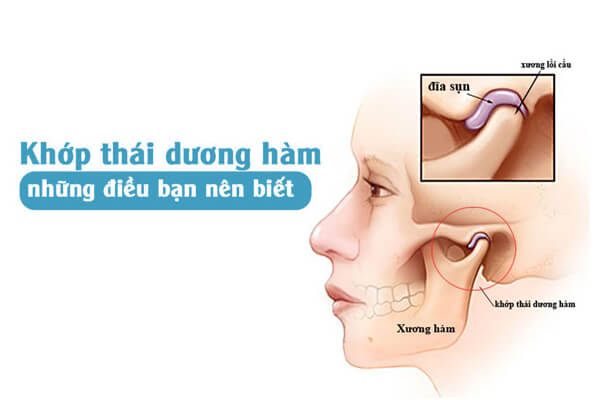 rối loạn khớp thái dương hàm